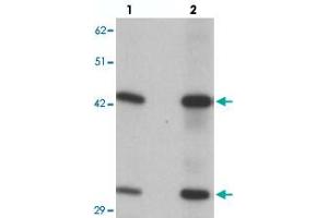 Western blot analysis of SEC62 in rat brain tissue with SEC62 polyclonal antibody  at (lane 1) 0. (SEC62 antibody  (C-Term))