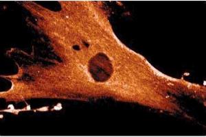 Immunofluorescence staining of WI-38 cells (Human lung fibroblasts, ATCC CCL-75). (ANXA6 antibody  (AA 1-673))