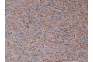 DAB staining on IHC-P; Samples: Rat Cerebrum Tissue (CYP7A1 antibody  (AA 109-383))