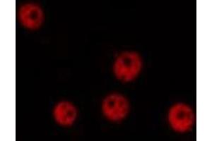 ABIN6276953 staining Hela by IF/ICC. (MNAT1 antibody  (N-Term))