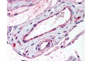 Immunohistochemical (Formalin/PFA-fixed paraffin-embedded sections) staining in vessels of human testis. (ADAMTS1 antibody)