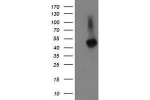 Image no. 1 for anti-Tubulin Folding Cofactor E-Like (TBCEL) antibody (ABIN1501325)