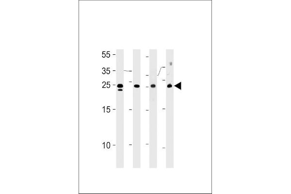 Translin anticorps  (AA 109-138)