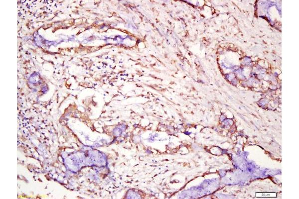 Tspan-8 antibody  (AA 101-200)