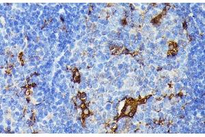 Immunohistochemistry of paraffin-embedded Mouse spleen using TIAL1 Polyclonal Antibody at dilution of 1:100 (40x lens). (TIAL1 antibody)