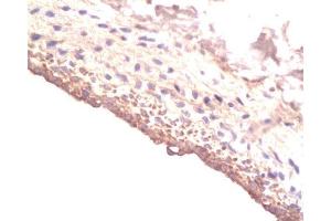 Formalin-fixed and paraffin-embedded rat Carotid artery labeled with Rabbit Anti-IGF-I Polyclonal Antibody , Unconjugated at 1:200 followed by conjugation to the secondary antibody and DAB staining (IGF1 antibody  (AA 49-100))