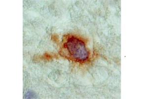 Immunohistochemistry (IHC) image for anti-Solute Carrier Family 18 (Vesicular Monoamine Transporter), Member 2 (SLC18A2) (N-Term) antibody (ABIN2781588)