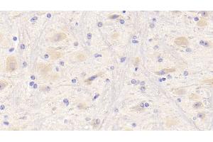 Detection of NRG1 in Mouse Cerebrum Tissue using Polyclonal Antibody to Neuregulin 1 (NRG1) (Neuregulin 1 antibody  (AA 54-163))