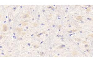 Detection of NRG1 in Mouse Cerebrum Tissue using Polyclonal Antibody to Neuregulin 1 (NRG1)