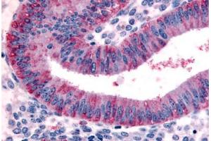 Human Uterus, Endometrium (formalin-fixed, paraffin-embedded) stained with DKK1 antibody ABIN213403 at 20 ug/ml followed by biotinylated goat anti-rabbit IgG secondary antibody ABIN481713, alkaline phosphatase-streptavidin and chromogen. (DKK1 antibody  (N-Term))