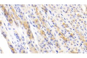 Detection of NFKB3 in Mouse Stomach Tissue using Polyclonal Antibody to Transcription Factor P65 (NFKB3) (NF-kB p65 antibody  (AA 19-306))