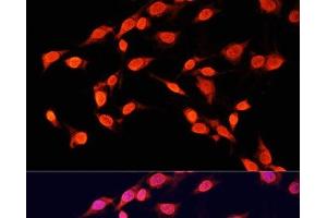 Immunofluorescence analysis of C6 cells using TriMethyl-Histone H3-K14 Polyclonal Antibody at dilution of 1:100 (40x lens). (Histone 3 antibody  (3meLys14))