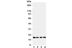 Western blot testing of Cyclophilin B antibody and Lane 1:  rat ovary;  2: HeLa;  3: 293T;  4: A431 cell lysate