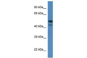 WB Suggested Anti-Sbk1 Antibody   Titration: 1.