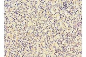 Immunohistochemistry of paraffin-embedded human spleen tissue using ABIN7147132 at dilution of 1:100 (Integrin beta 2 antibody  (AA 24-220))