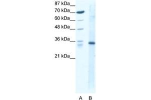 Western Blotting (WB) image for anti-Kruppel-Like Factor 3 (Basic) (KLF3) antibody (ABIN2460389)