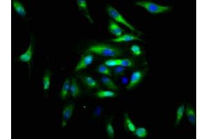 Immunofluorescence staining of Hela cells with ABIN7152853 at 1:166, counter-stained with DAPI. (FGFRL1 antibody  (AA 403-470))