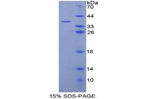 SDS-PAGE (SDS) image for Complement Fragment 3a (C3a) (AA 672-748) protein (His tag,GST tag) (ABIN1878334)