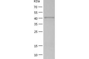Western Blotting (WB) image for RAD52 Homolog (S. Cerevisiae) (RAD52) (AA 1-418) protein (His tag) (ABIN7286158) (RAD52 Protein (AA 1-418) (His tag))