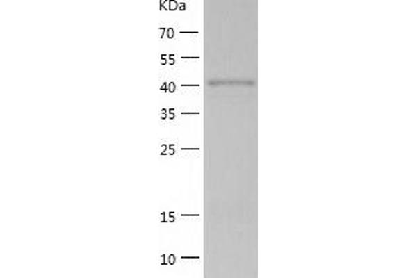 RAD52 Protein (AA 1-418) (His tag)