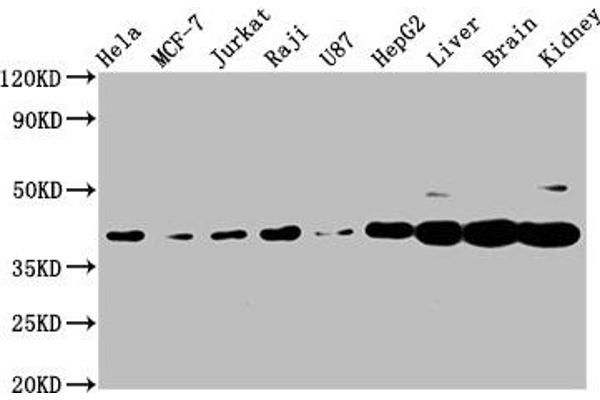 PNCK antibody  (AA 1-115)