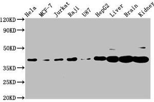 Western Blot Positive WB detected in: Hela whole cell lysate, MCF-7 whole cell lysate, Jurkat whole cell lysate, Raji whole cell lysate, U87 whole cell lysate, HepG2 whole cell lysate, Rat liver tissue, Mouse brain tissue, Mouse kidney tissue All lanes: PNCK antibody at 3. (PNCK antibody  (AA 1-115))