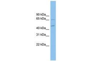 Image no. 1 for anti-Malate Dehydrogenase 1B, NAD (Soluble) (MDH1B) (C-Term) antibody (ABIN6744921) (MDH1B antibody  (C-Term))