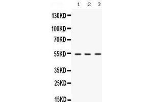 Western blot analysis of SPTLC1 expression in rat brain extract (lane 1), mouse brain extract (lane 2) and MCF-7 whole cell lysates (lane 3).