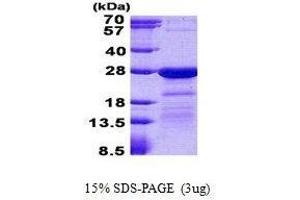 Figure annotation denotes ug of protein loaded and % gel used. (HN1L Protein)