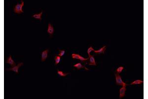 ABIN6266632 staining HeLa cells by IF/ICC.