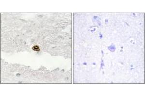 Immunohistochemistry analysis of paraffin-embedded human brain, using DGKZ Antibody. (DGKZ antibody  (AA 601-650))