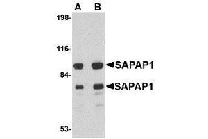 Image no. 1 for anti-Discs, Large (Drosophila) Homolog-Associated Protein 1 (DLGAP1) (Internal Region) antibody (ABIN1493797) (DLGAP1 antibody  (Internal Region))
