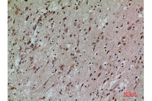 Immunohistochemistry (IHC) analysis of paraffin-embedded Human Brain, antibody was diluted at 1:100. (CD58 antibody  (Internal Region))