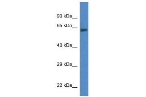 Western Blot showing ACSF2 antibody used at a concentration of 1 ug/ml against Fetal Lung Lysate (ACSF2 antibody  (C-Term))
