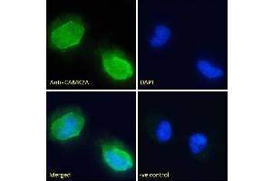 (ABIN570984) Immunofluorescence analysis of paraformaldehyde fixed U251 cells, permeabilized with 0. (CaMKII alpha/beta (Internal Region) antibody)