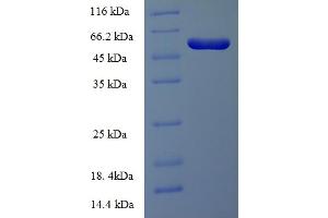 SDS-PAGE (SDS) image for Integrin-Linked Kinase-Associated Serine/threonine Phosphatase 2C (ILKAP) (AA 1-392), (full length) protein (His-SUMO Tag) (ABIN5709757)