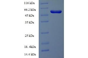 SDS-PAGE (SDS) image for Integrin-Linked Kinase-Associated Serine/threonine Phosphatase 2C (ILKAP) (AA 1-392), (full length) protein (His-SUMO Tag) (ABIN4975755) (ILKAP Protein (AA 1-392, full length) (His-SUMO Tag))