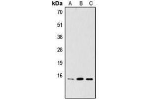 Western blot analysis of PDRG1 expression in HeLa (A), MCF7 (B), A2058 (C) whole cell lysates. (PDRG1 antibody  (Center))