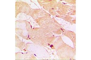 Immunohistochemical analysis of Dysferlin staining in human muscle formalin fixed paraffin embedded tissue section. (Dysferlin antibody  (C-Term))