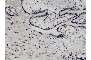 Immunoperoxidase of monoclonal antibody to MED26 on formalin-fixed paraffin-embedded human placenta. (MED26 antibody  (AA 501-600))