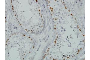 Immunoperoxidase of monoclonal antibody to SALL4 on formalin-fixed paraffin-embedded human testis. (SALL4 antibody  (AA 954-1053))