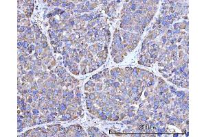 IHC analysis of RPN1 using anti-RPN1 antibody (ABIN7600447). (RPN1 antibody  (AA 196-495))