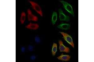ABIN6257638 and ABIN6274781 staining Hela cells by IF/ICC.