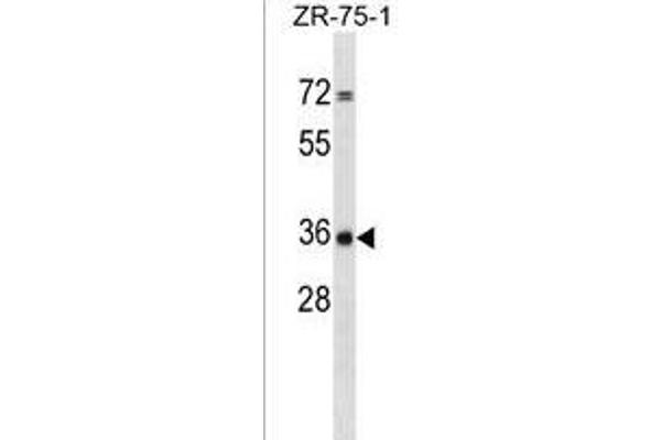 Cpped1 antibody  (C-Term)