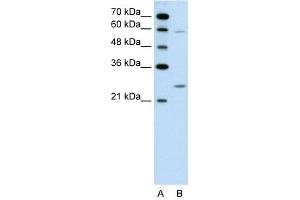 GAMT antibody used at 0. (GAMT antibody  (N-Term))