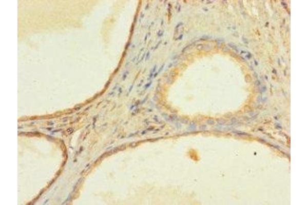 ZNF432 antibody  (AA 1-260)