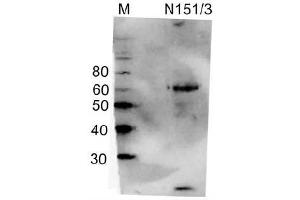 Cerebellar lysate immunoblot probed with N151/3 (3 mg/mL).
