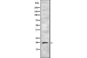 Western blot analysis of ARF5 using K562 whole cell lysates (ARF5 antibody  (C-Term))