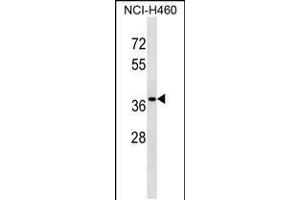 Western blot analysis in NCI-H460 cell line lysates (35ug/lane). (CUTC antibody  (AA 67-94))