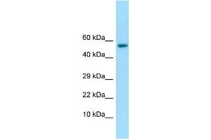 WB Suggested Anti-IFIT1 Antibody Titration: 1. (IFIT1 antibody  (C-Term))